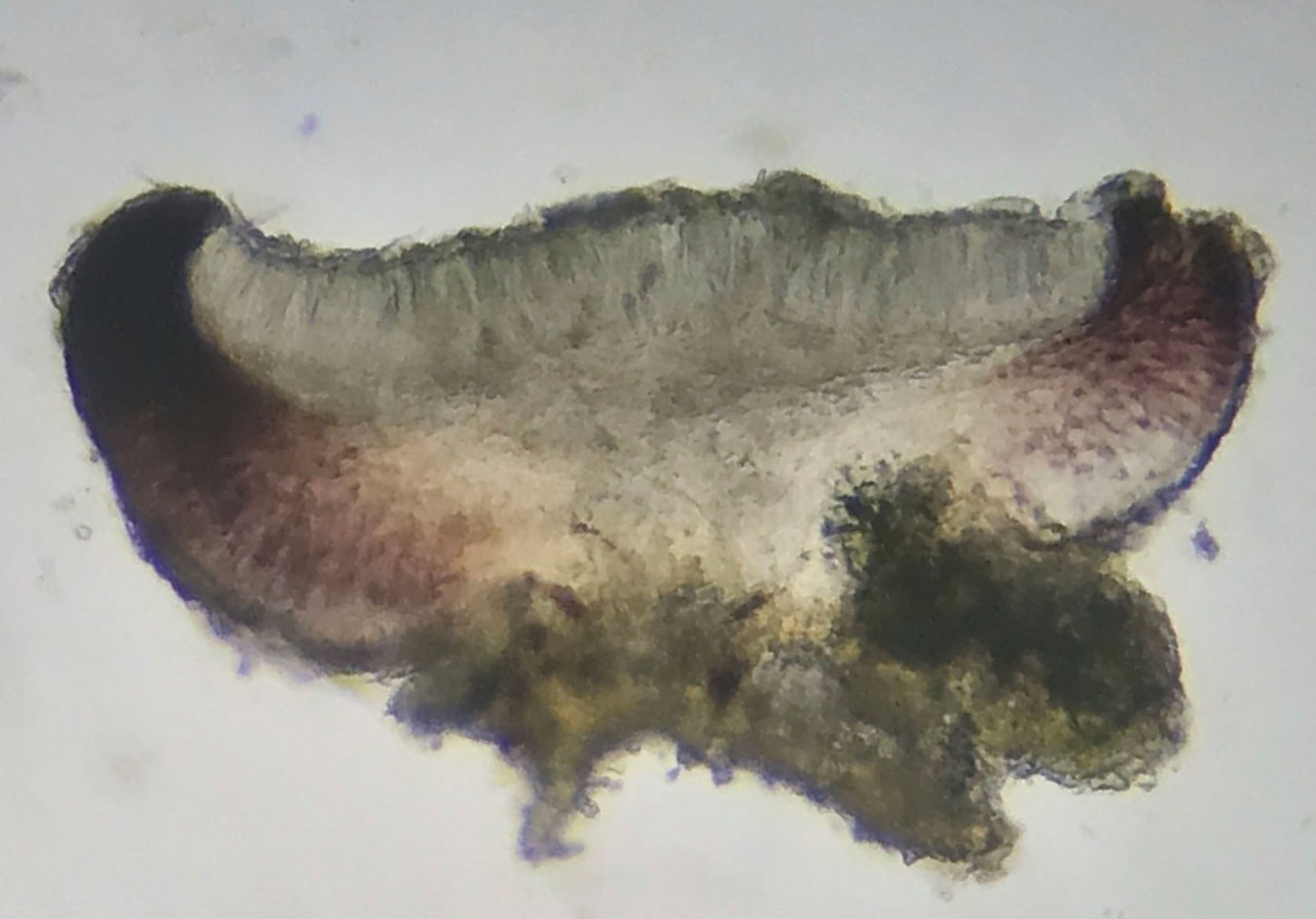 Scutula circumspecta, apothecia cross section in K, on Beech, Long Beech Inclosure, New Forest © Neil A Sanderson Scutula circumspecta, Long Beech Inclosure, New Forest