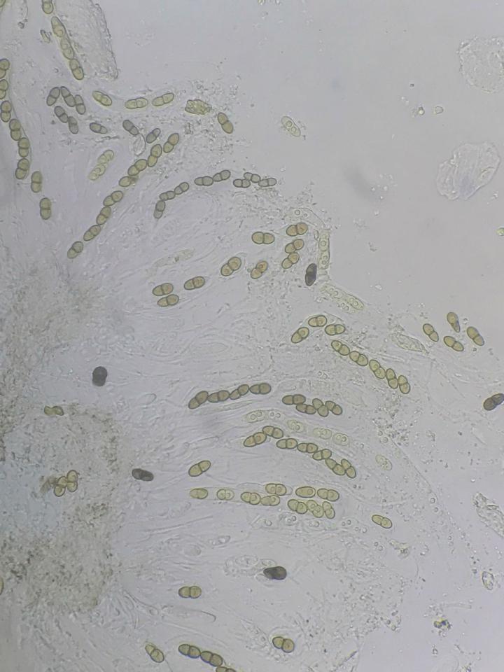 Didymocyrtis slaptoniensis spores
