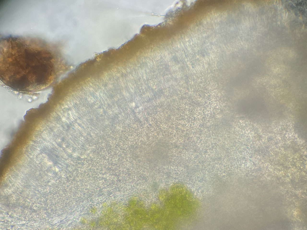 Caloplaca flavorubescens, apothecia showing lower hymenium and hypothecium with numerous oil droplets, ancient Ash, Parham Park, Sussex © Neil A Sanderson  Caloplaca flavorubescens, apothecia, Parham Park, Sussex