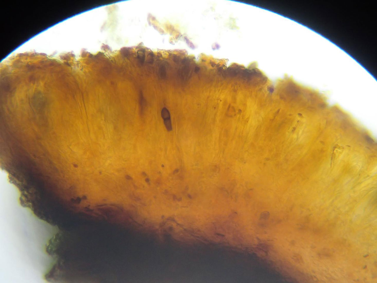 Melaspilea ochrothalamia, apothecium cross-section, Oak, oceanic woodland, west Cumbria