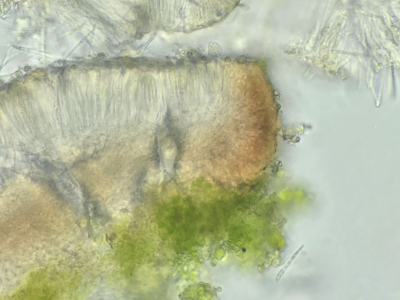 Scutula circumspecta, apothecia cross section in K, pigment deficient form, Beech, north of Ironshill Inclosure, New Forest © Neil A Sanderson Scutula circumspecta, apothecia cross section, pigment deficient form, Beech, north of Ironshill Inclosure, New Forest